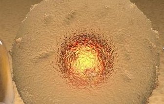 乌鲁木齐试管婴儿费用解析